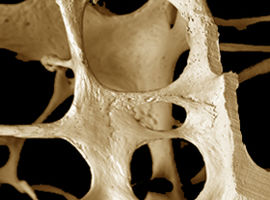 Bezpłatne badanie osteoporozy